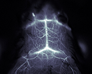 Illustration for article titled See Inside a Living Mouse Brain Thanks to Lasers and Carbon Nanotubes